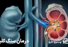 بهترین قرص برای دفع سنگ کلیه