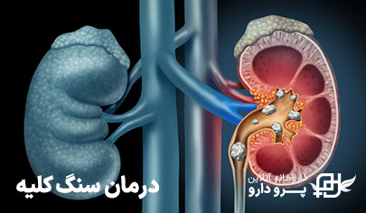 بهترین قرص برای دفع سنگ کلیه